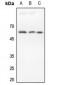 Anti-DR4 Antibody